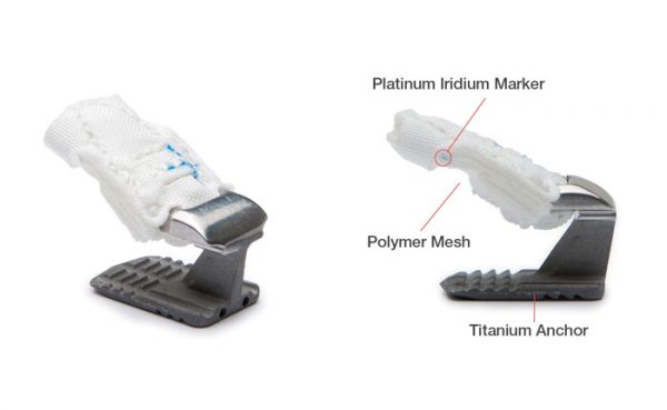 Intrinsic-Therapeutics-platinum