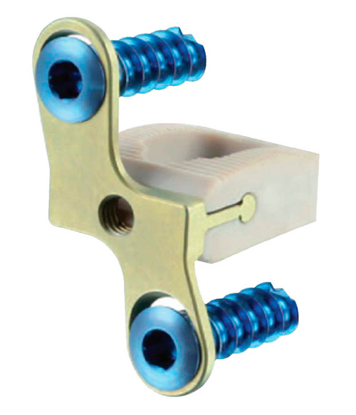 Sistema-de-jaula-cervical