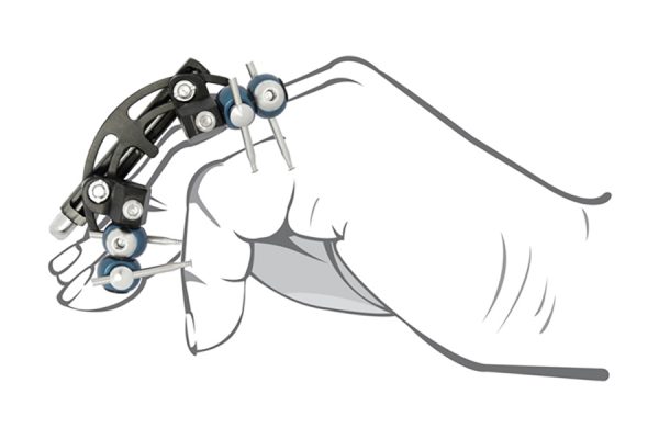 MINIFLO – Disegno anatomico