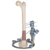 fijador-externo-femur4